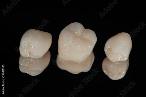 Ceramic dental crowns on the mirror, chewing teeth photo