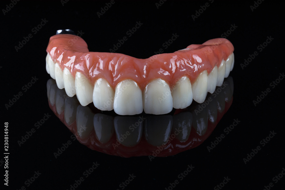 beautiful dentures with imitation of natural gums, stylishly filmed on the black glass with reflection beautiful dentures with imitation of natural gums, stylishly filmed on the black glass with reflection
