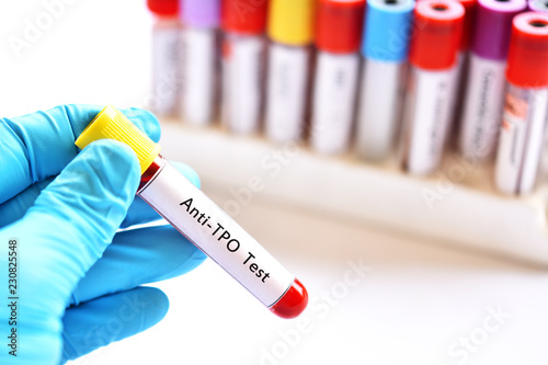 Blood sample tube for anti-TPO or anti-thyroid peroxidase test, diagnosis for thyroid hormone disease photo