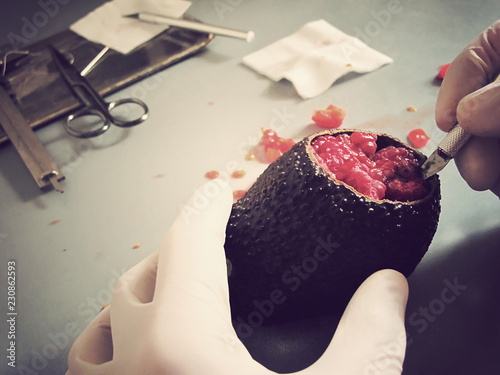 Fotografi Food autopsy