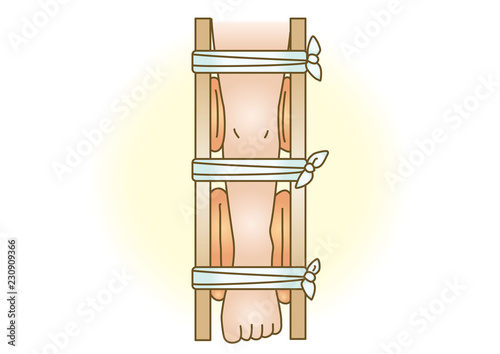 応急手当イラスト36：骨折・下肢