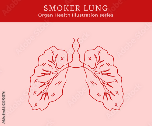 Sick Smoker lung illustration outline line art monoline style