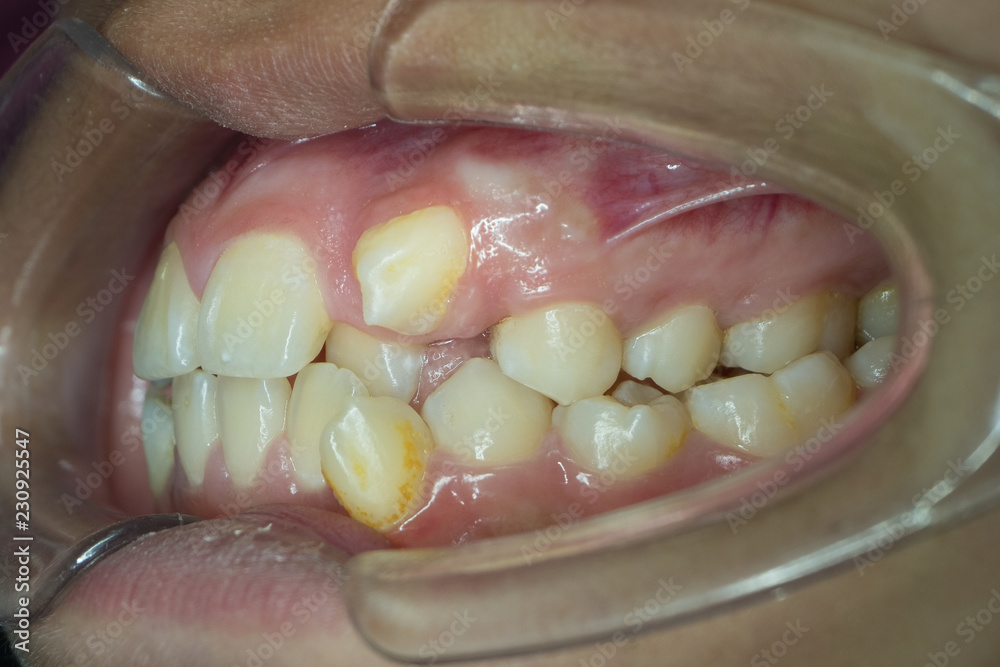 Lush The Gap Where A Large Canine Tooth Can Rest Landscape Art Lush The Gap Where A Large Canine Tooth Can Rest Landscape Art