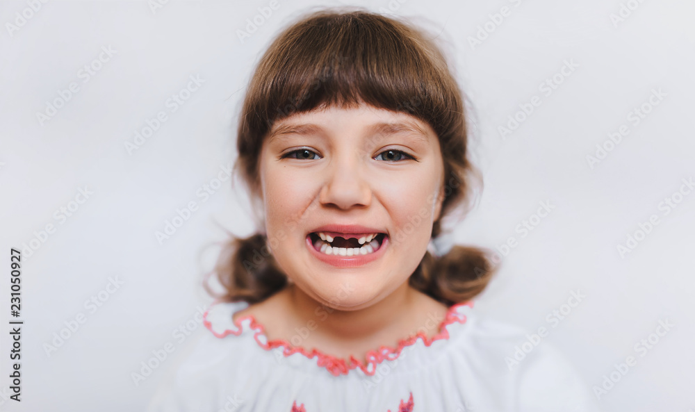 A little girl shows her milk teeth. Temporary baby teeth fall out. Toothless first grader. A little girl shows her milk teeth. Temporary baby teeth fall out. Toothless first grader.
