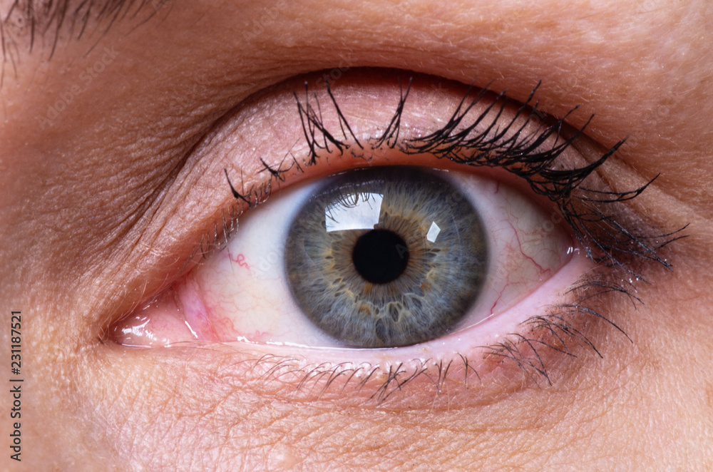Red eye of a woman Red eye of a woman