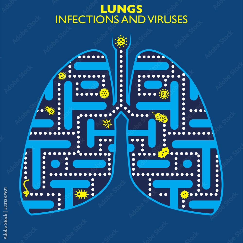 Obraz premium Polmoni infezioni e virus. Presenza di forme infettive e di virus