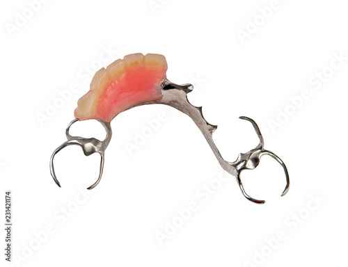 Chromium removable lower partial denture