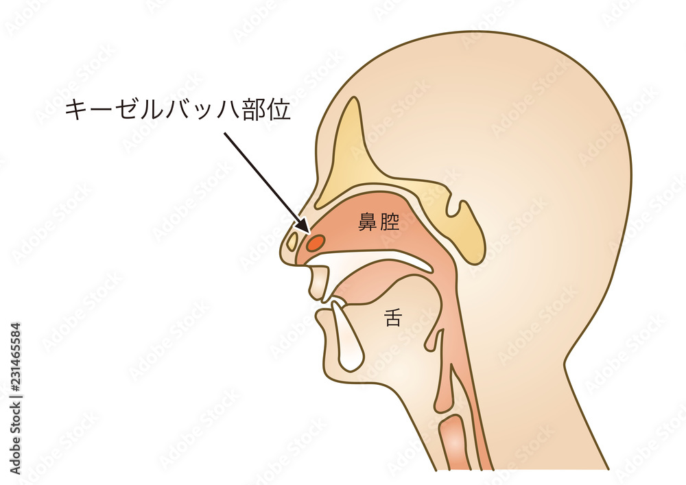 応急手当イラスト64 鼻血 Stock Vector Adobe Stock 応急手当イラスト64 鼻血 Stock Vector Adobe Stock