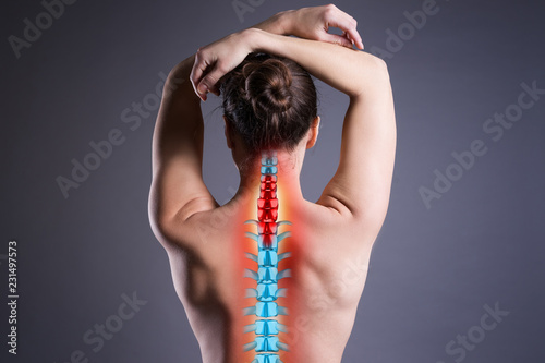 Schilderij op canvas Pain in the spine, woman with backache on gray background, back injury