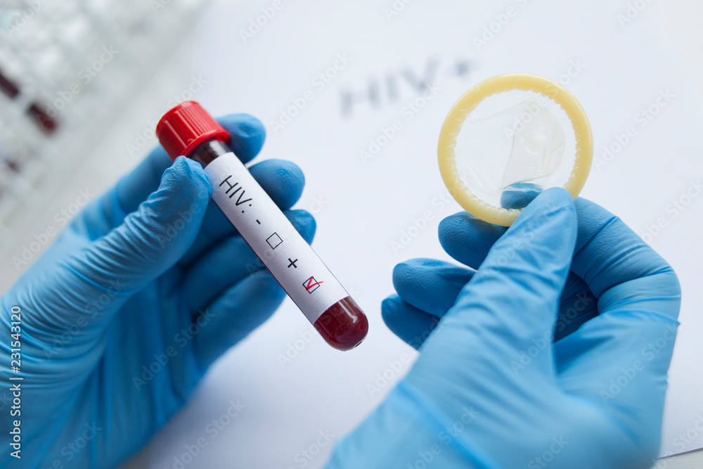 Diagnostician holding in hand a positive HIV test. Diagnostician holding in hand a positive HIV test.