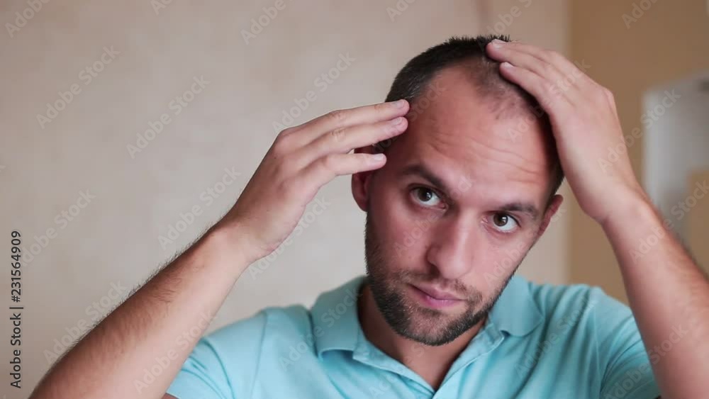 Caucasian young man controls hair loss