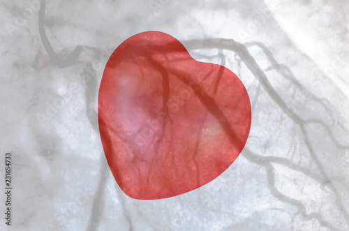 Catheterization. Cardiac ventriculography and small red heart photo