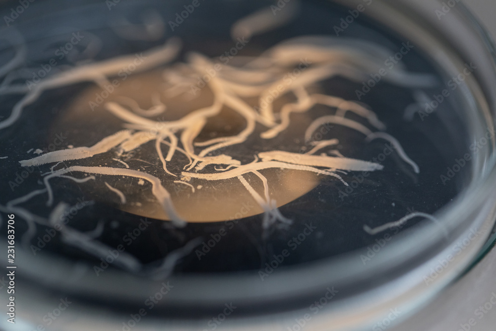 Ascariasis is a disease caused by the parasitic roundworm Ascaris ...