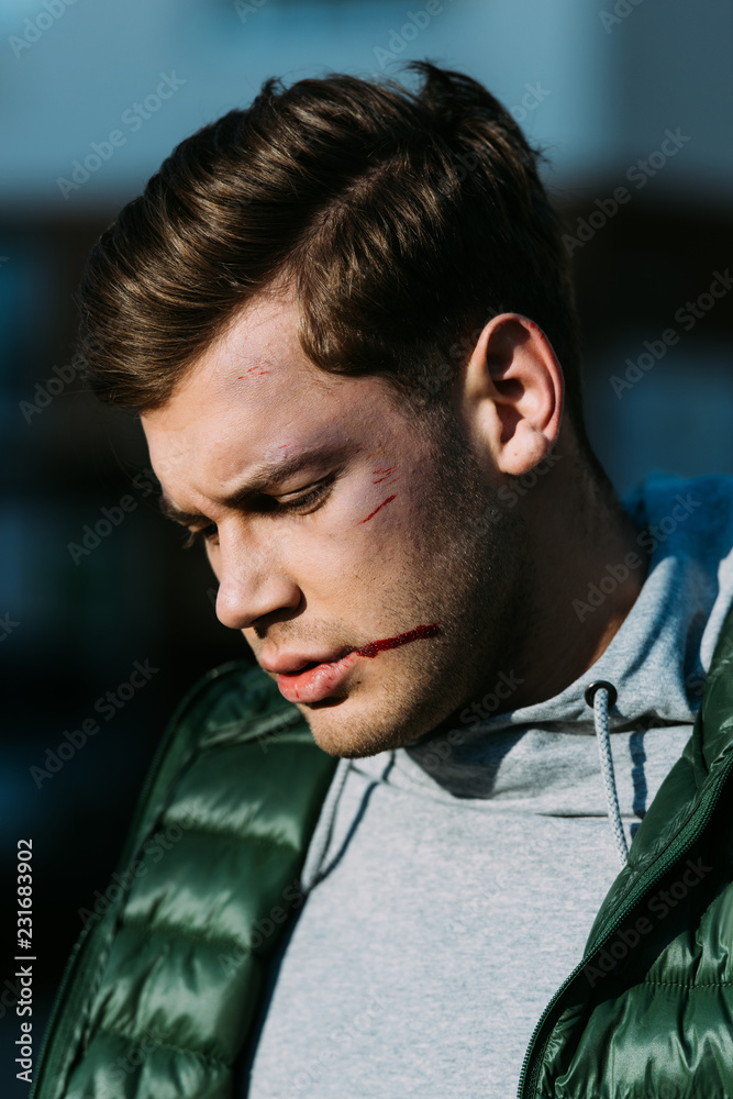 close-up view of injured man with blood on face after traffic collision close-up view of injured man with blood on face after traffic collision