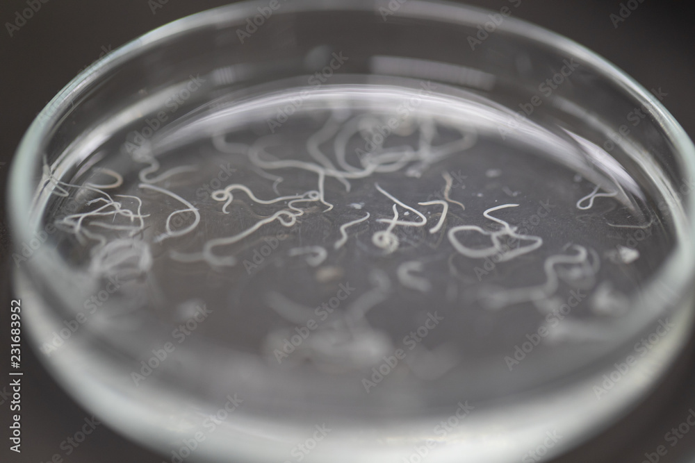 Ascariasis is a disease caused by the parasitic roundworm Ascaris ...