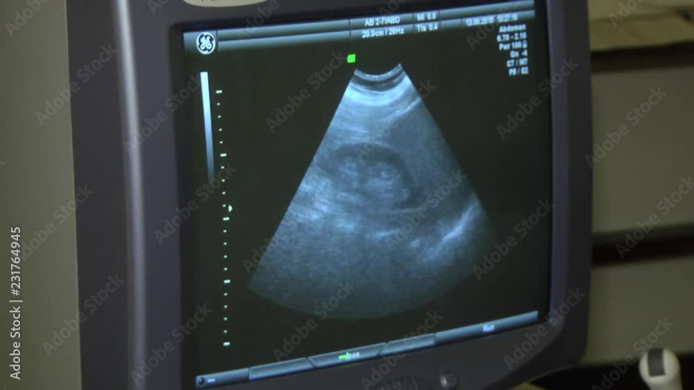 Image of human organs on the display ultrasound system, close up view ... Biology Diagrams