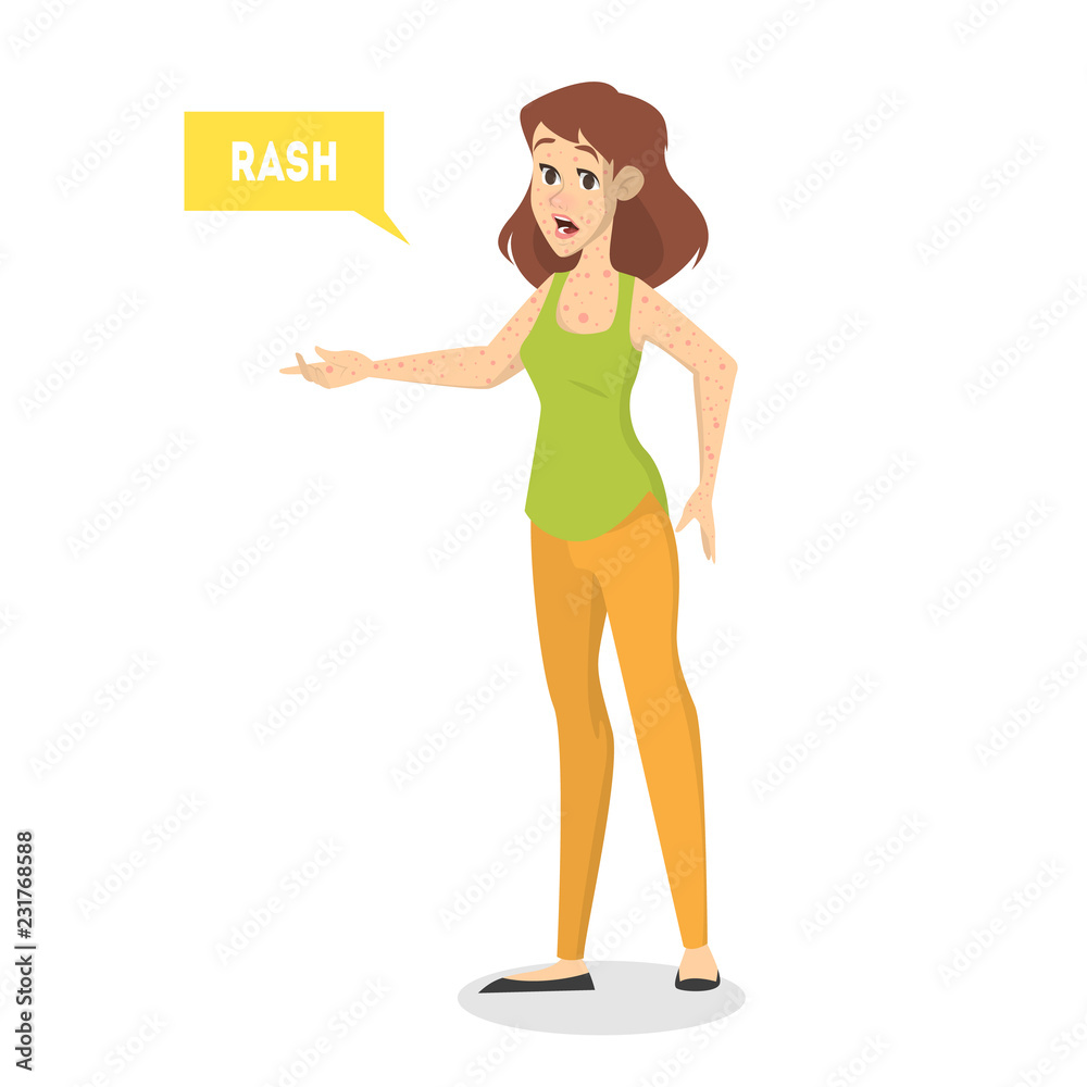 Woman with skin full of rash. Dermatology disease Woman with skin full of rash. Dermatology disease