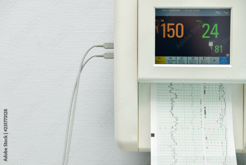 Φωτογραφία Monitor for measuring contractions, heartbeat of a pregnant woman