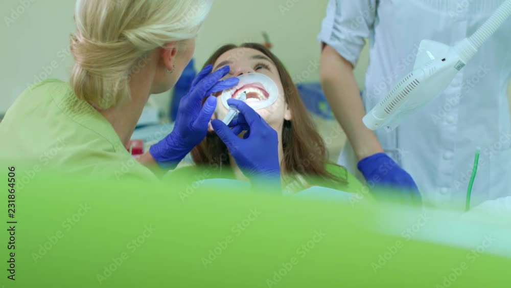 Stockvideon Professional whitening teeth procedure in dental office
