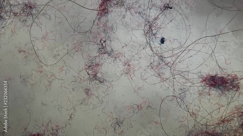 Synthetic fibers released from fabrics clothing in the form of microscopic plastic fibers every time we wash our laundry. The fibers damage the stomach of fish and seafood