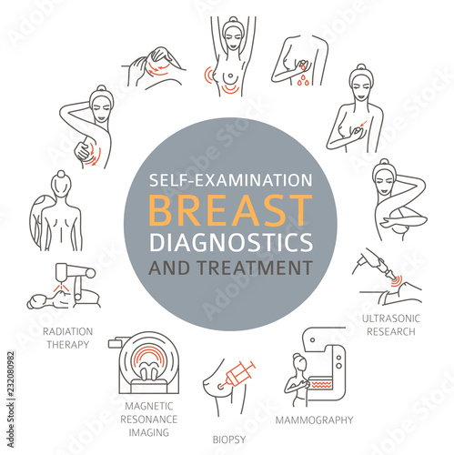 Breast cancer, medical infographic. Diagnostics, symptoms, self examination. Women`s health set