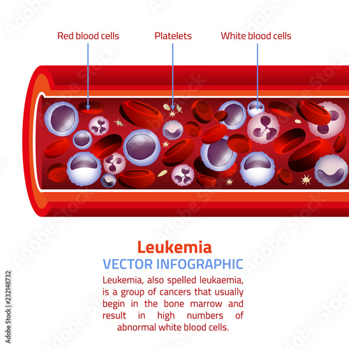 Leukemia blood vessel