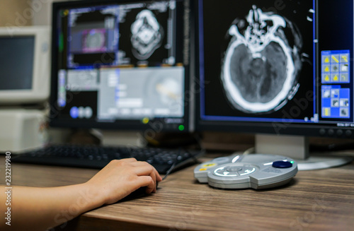 Radiotechnologist hand holding mouse while working on CT scan workstation, CT brain image is background photo