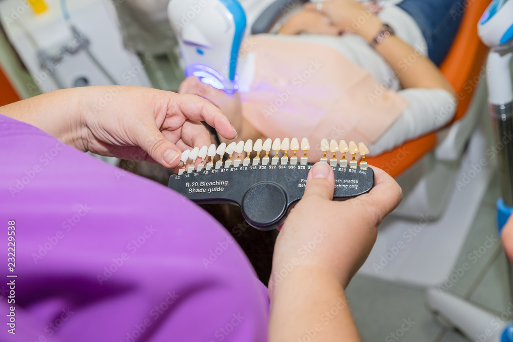 Fototapeta premium dentist choosing color teeth from palette for tooth color.Examining a whiteness of teeth of a patient at the dentist.Matching the shades of the implants or the process of teeth whitening.