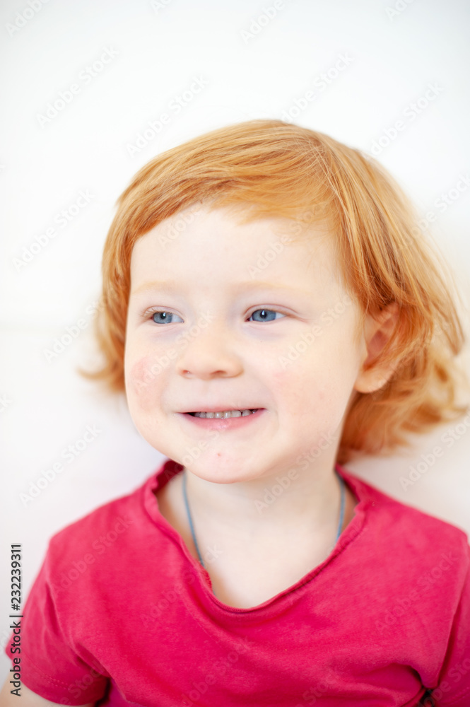 Allergies, atopic dermatitis on the face of a baby Allergies, atopic dermatitis on the face of a baby