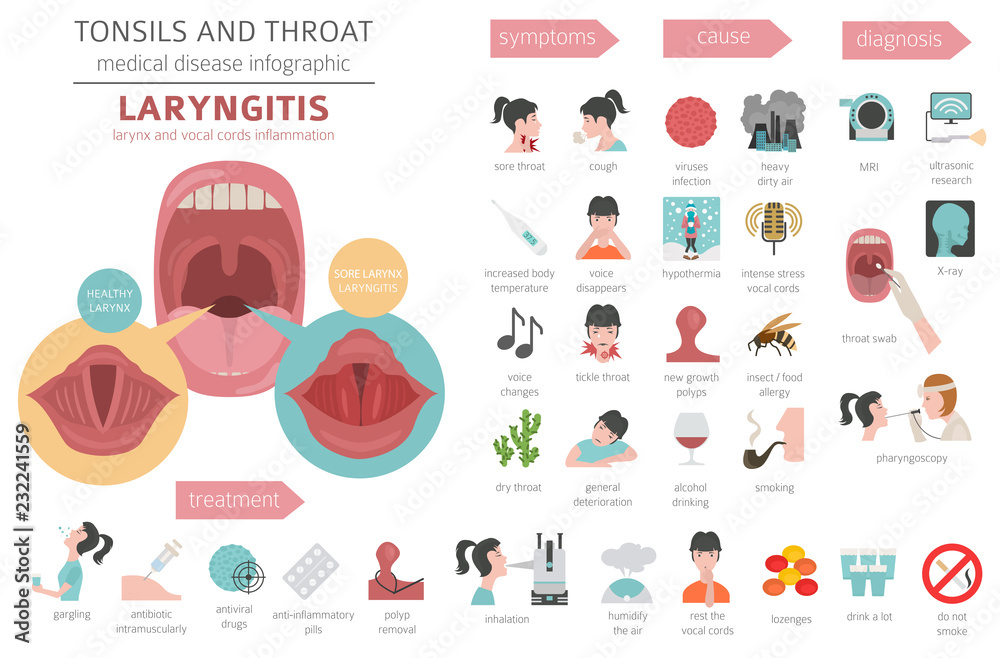 Fototapeta premium Tonsils and throat diseases. Laryngitis symptoms, treatment icon set. Medical infographic design