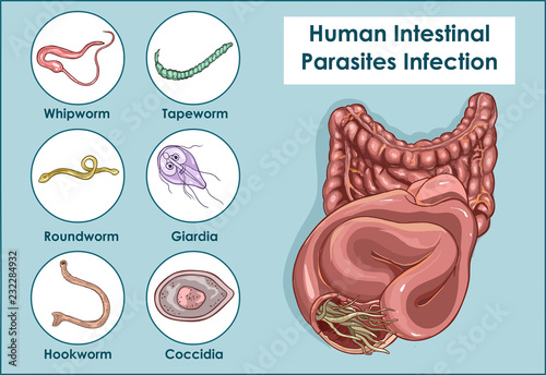 Vector Illustration of a Human Intestinal Parasites