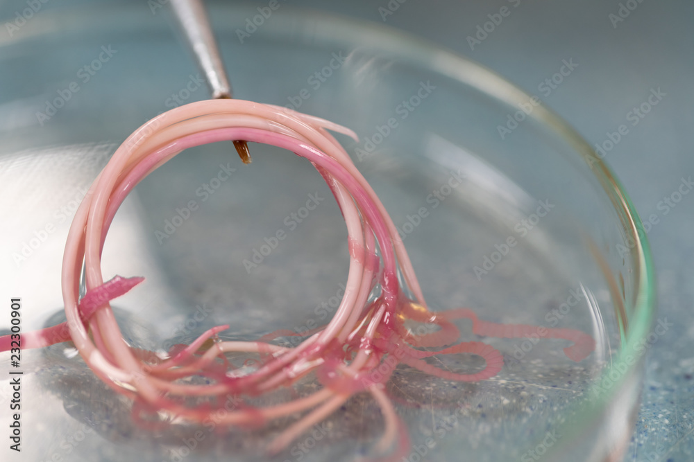 Ascariasis is a disease caused by the parasitic roundworm Ascaris ...