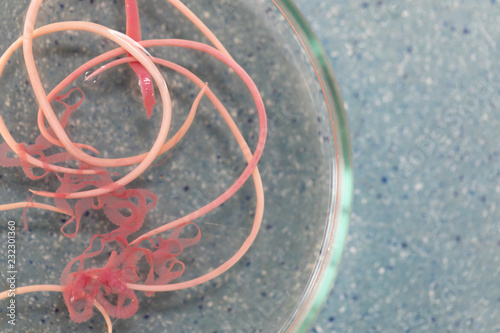 Ascariasis is a disease caused by the parasitic roundworm Ascaris lumbricoides for education in laboratories. photo