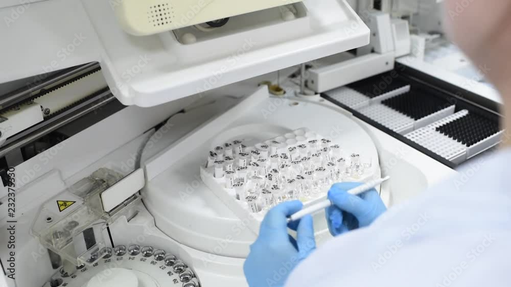 Immunology. Laboratory equipment, automation, modern automated machine in the working process, clinical chemistry analyzer, chemical pathology, Medical biochemistry, body fluids analysis, blood and