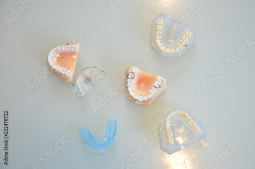 歯科模型と矯正装置