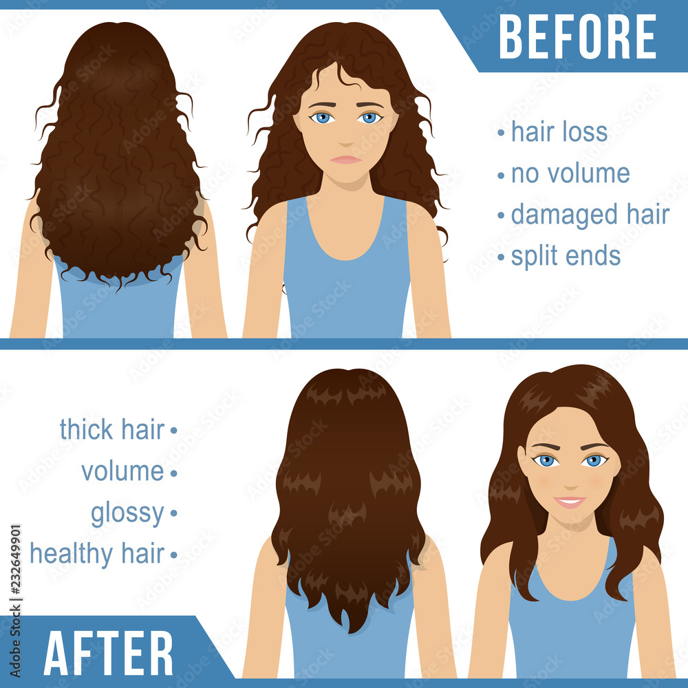 Care For Wavy Hair. Common Problems - Split Ends, Damaged, Loss. Before And  After Hair Care Treatment. Vector Royalty Free SVG, Cliparts, Vectors, and  Stock Illustration. Image 127726347.