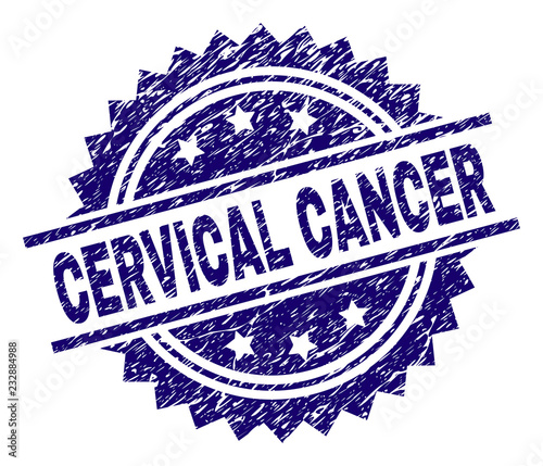 CERVICAL CANCER stamp seal watermark with distress style. Blue vector rubber print of CERVICAL CANCER text with corroded texture.