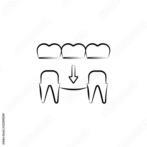 implant, prosthesis icon. Element of dantist for mobile concept and web apps illustration. Hand drawn icon for website design and development, app development