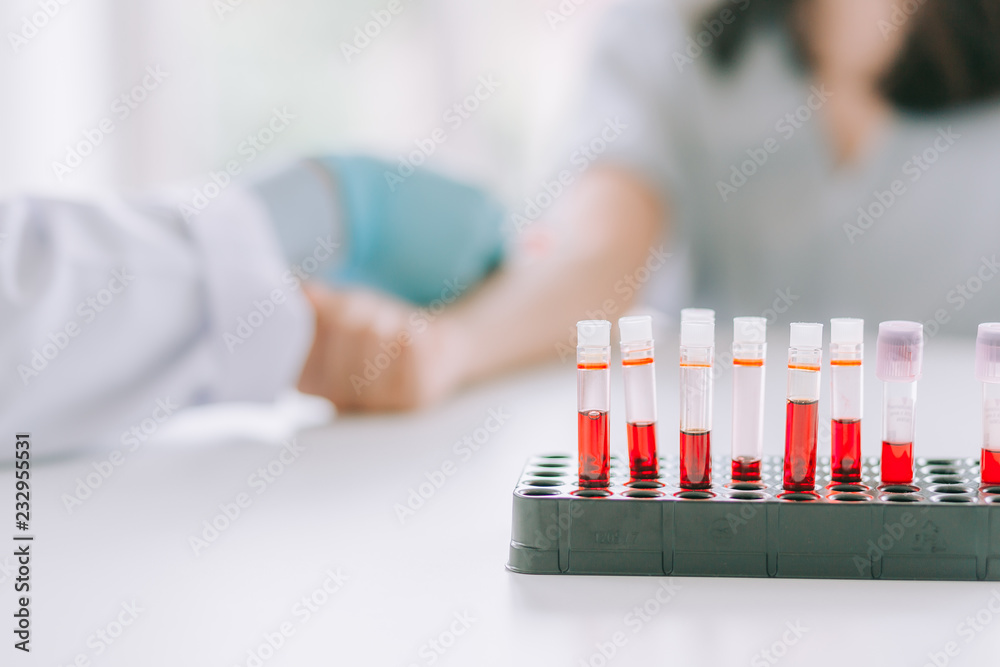 Blood sample Test tube , blurred background : Hand of nurse, doctor or Medical technologist in blue gloves taking blood sample from a patient in the hospital. Blood sample Test tube , blurred background : Hand of nurse, doctor or Medical technologist in blue gloves taking blood sample from a patient in the hospital.