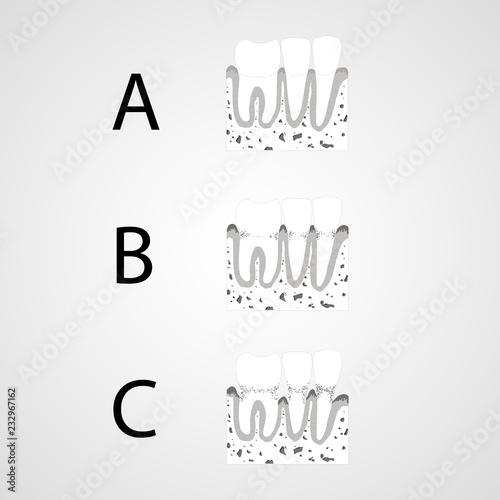 Tooth isolated flat vector image