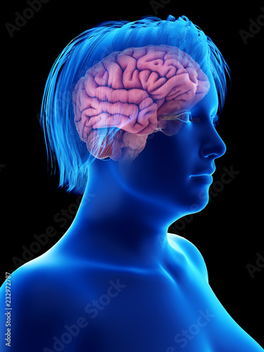 3d rendered medically accurate illustration of an obese womans brain