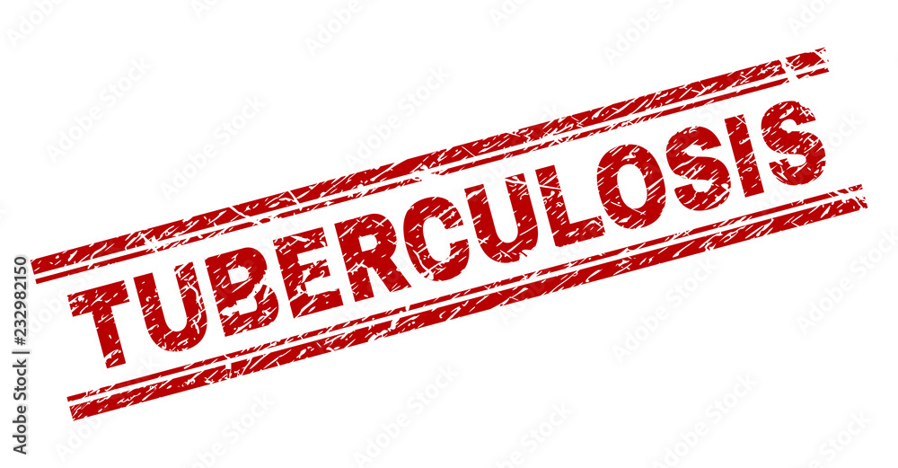TUBERCULOSIS seal stamp with grunge texture. Red vector rubber print of TUBERCULOSIS text with unclean texture. Text label is placed between double parallel lines. TUBERCULOSIS seal stamp with grunge texture. Red vector rubber print of TUBERCULOSIS text with unclean texture. Text label is placed between double parallel lines.