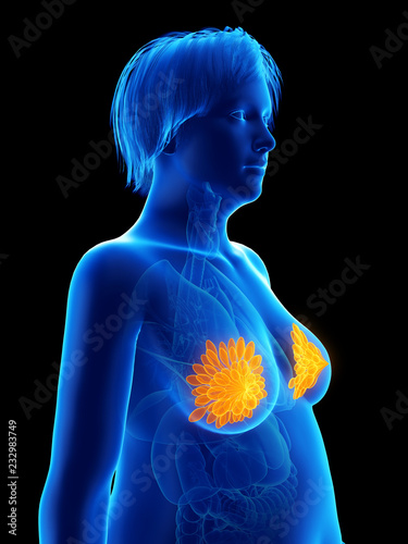 3d rendered medically accurate illustration of an obese womans mammary glands