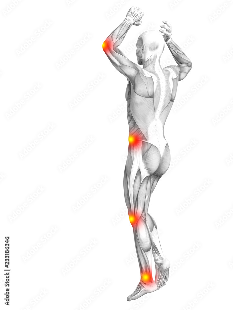 Conceptual human muscle anatomy with red and yellow hot spot inflammation or articular joint pain for health care therapy or sport concepts. 3D illustration man arthritis or bone osteoporosis disease Conceptual human muscle anatomy with red and yellow hot spot inflammation or articular joint pain for health care therapy or sport concepts. 3D illustration man arthritis or bone osteoporosis disease