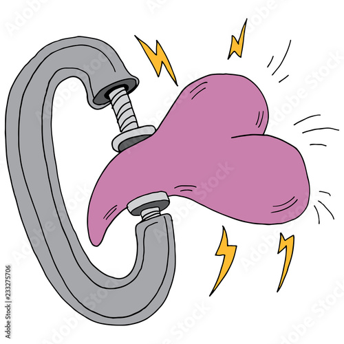 Clamp Heart Attack Clogged Artery