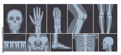 Vector illustration of realistic set of many X-rays pictures of human body. Transparent X-ray photos on white background. photo