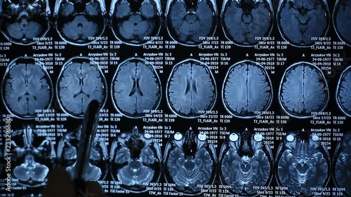 Medical doctor analyzing MRI CT scan. He found a problem.