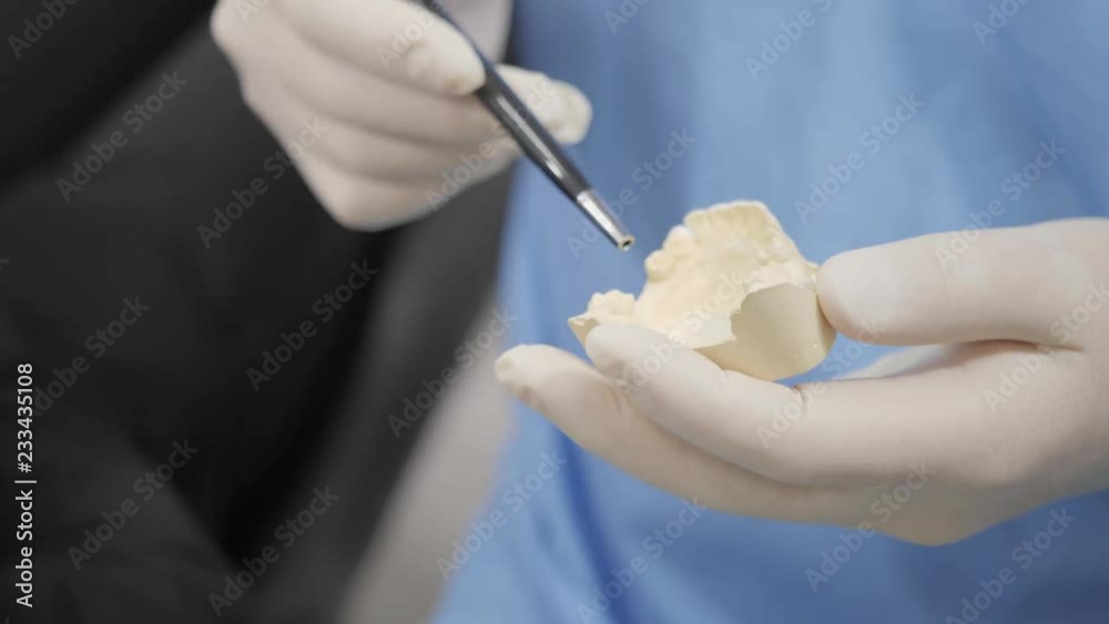 The doctor shows a cast of the jaw, fillings and implants. Medicine, health, stomatology concept. dentist treating a patient. The doctor shows a cast of the jaw, fillings and implants. Medicine, health, stomatology concept. dentist treating a patient.