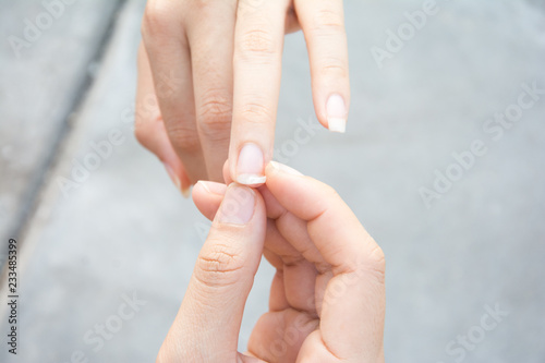 Image of a broken nail hand
