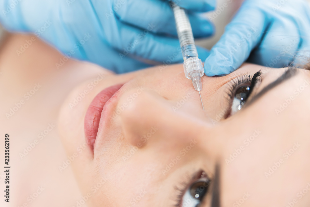 Hyaluron fillers